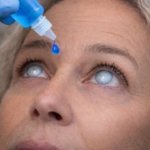 Científicos desarrollarían gotas que podrían tratar las cataratas sin cirugía