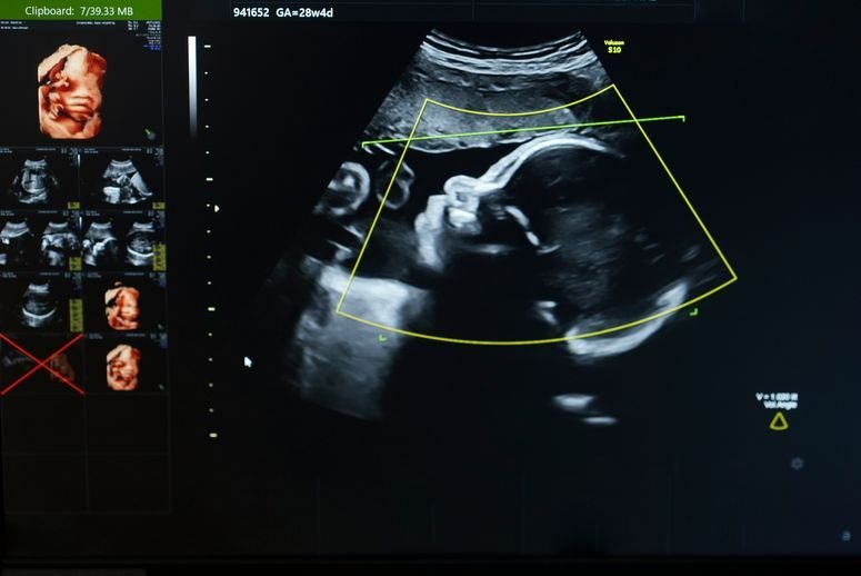 Las sustancias perfluoroalquiladas y polifluoroalquiladas (PFAS) pueden atravesar la placenta y poner en peligro la salud del feto.