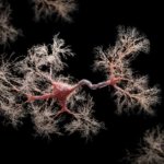 Cómo es vivir con un implante cerebral durante 5 años