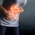 Reflujo Gastroesofágico es motivo frecuente para consultas